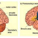 Pictures Of Broca’s Motor Speech Area