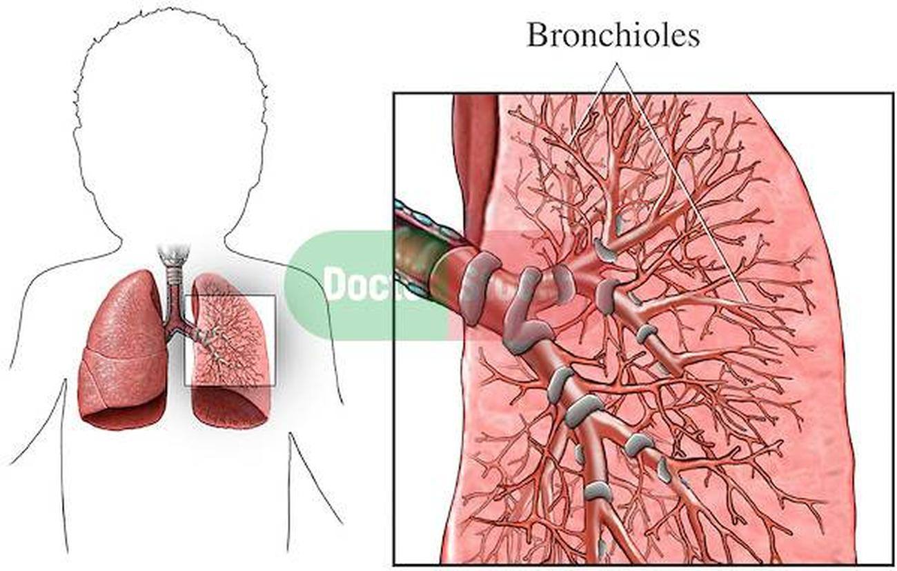 Pictures Of Bronchioles