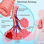 Pictures Of Bronchioles