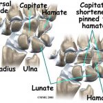 Pictures Of Capitate