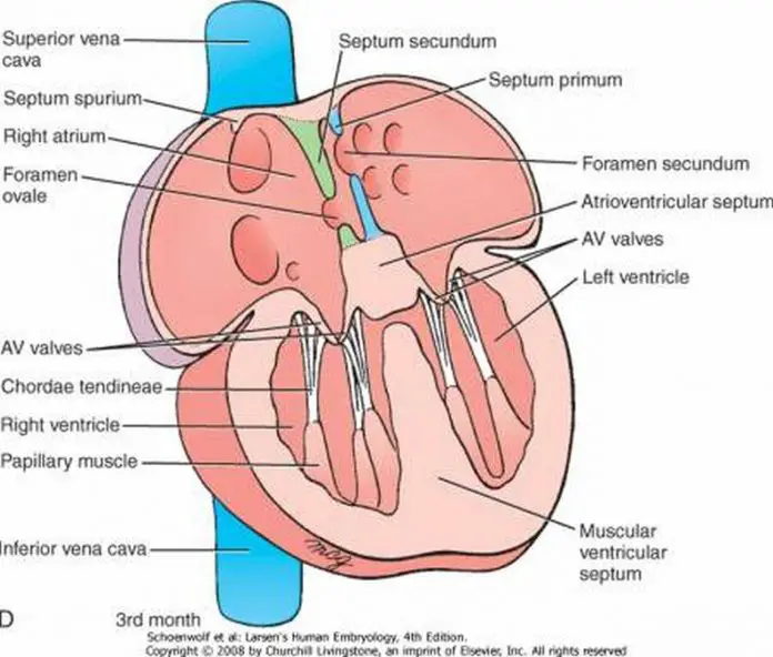 Pictures Of Cardiac Septum