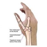Pictures Of Carpometacarpal Joint Of The Thumb