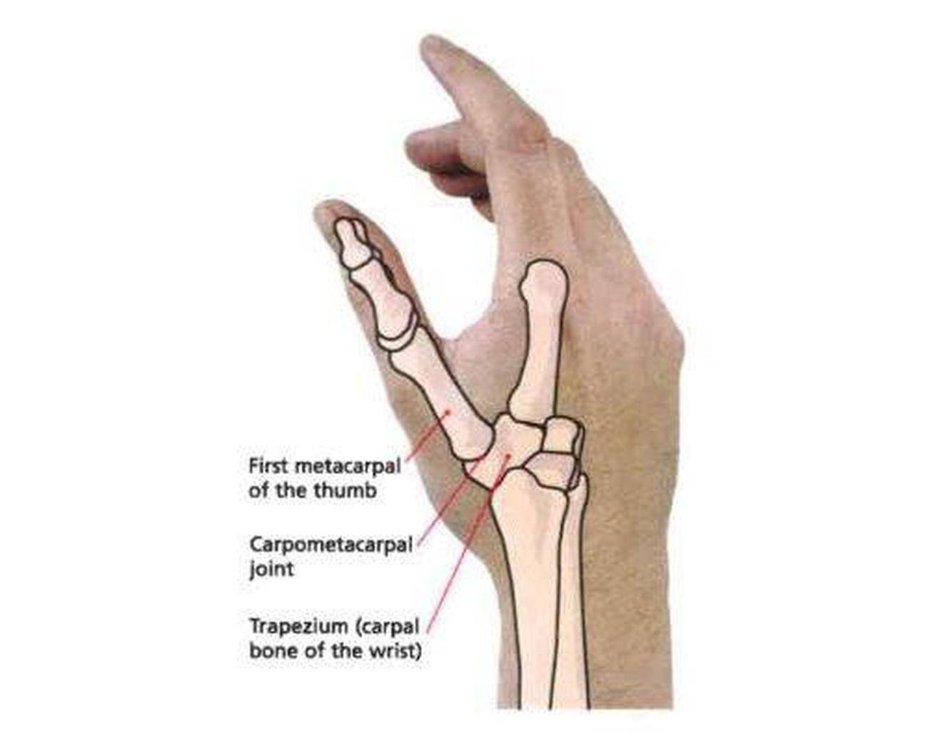 Pictures of Carpometacarpal Joint of the Thumb 1295. 