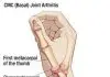 Pictures Of Carpometacarpal Joints