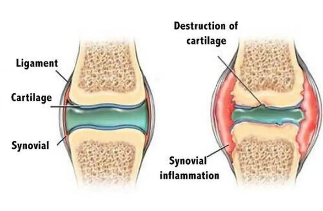 lm-of-a-section-through-hyaline-cartilage-stock-image-p174-0027