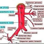 Pictures Of Celiac Artery