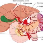 Pictures Of Celiac Artery