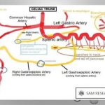 Pictures Of Celiac Artery