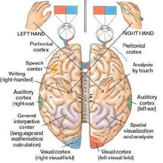 Pictures Of Cerebral Hemispheres Healthiack