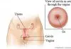 Pictures Of Cervix