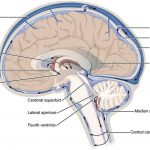 Pictures Of Choroid Plexus