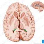 Pictures Of Choroid Plexus