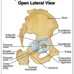 Pictures Of Acetabulum