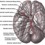 Pictures Of Anterior Communicating Artery