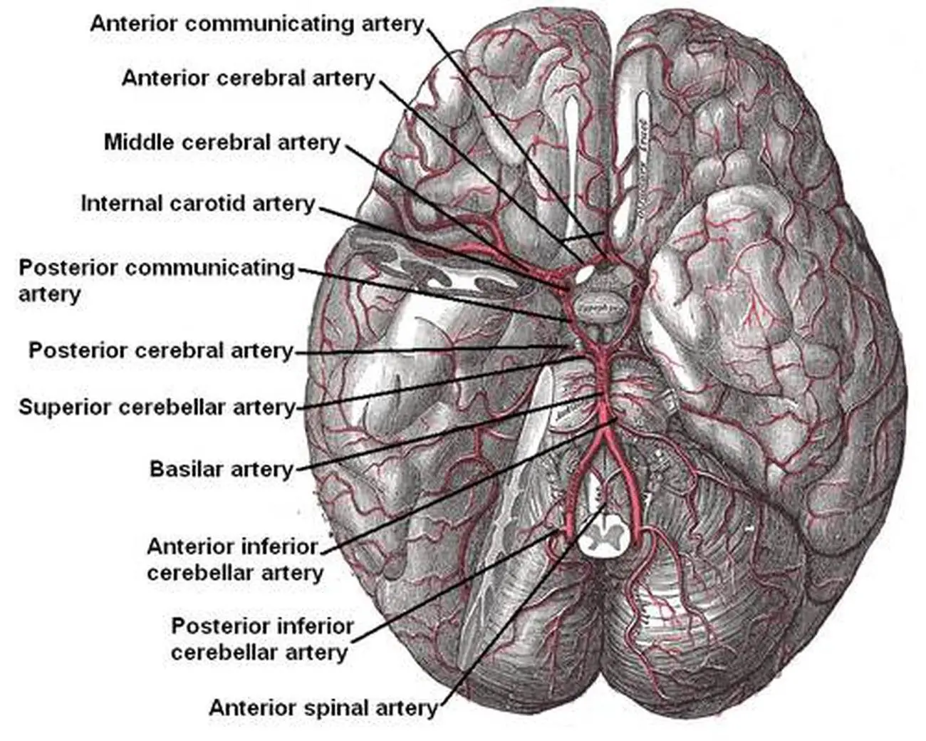 Pictures Of Anterior Communicating Artery