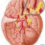 Pictures Of Anterior Communicating Artery