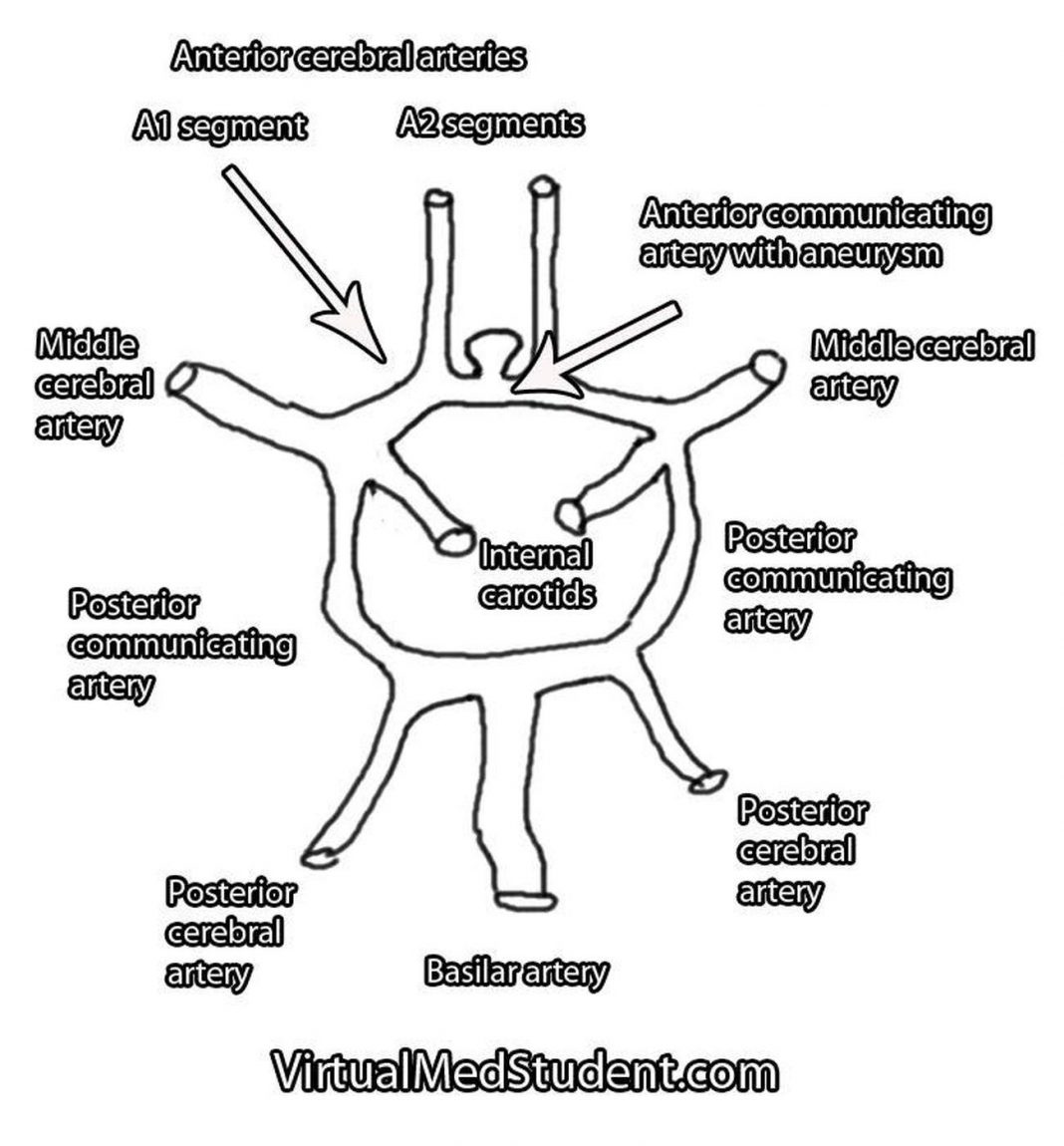 Pictures Of Anterior Communicating Artery