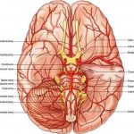 Pictures Of Anterior Communicating Artery