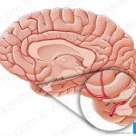 Pictures Of Anterior Communicating Artery