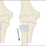 Pictures Of Anular Ligament