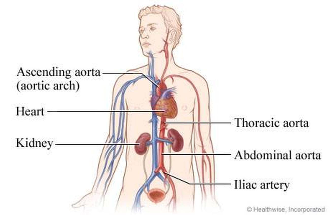 Pictures Of Aorta