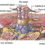 Pictures Of Arachnoid Membrane