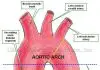 Pictures Of Ascending Aorta