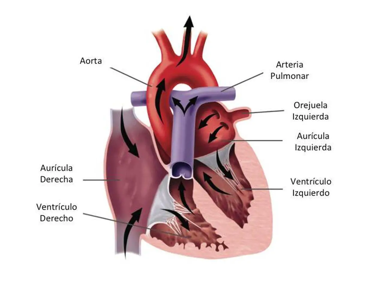 Pictures Of Atrial Appendage (auricle)