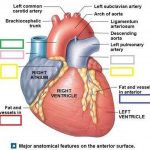 Pictures Of Atrial Appendage (auricle)