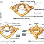 Pictures Of Axis Vertebra, Odontoid Process