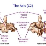 Pictures Of Axis Vertebra, Odontoid Process