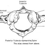 Pictures Of Axis Vertebra, Odontoid Process