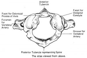 Pictures Of Axis Vertebra, Odontoid Process