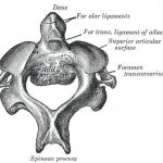 Pictures Of Axis Vertebra, Odontoid Process