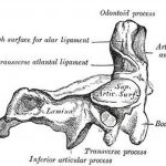 Pictures Of Axis Vertebra, Odontoid Process