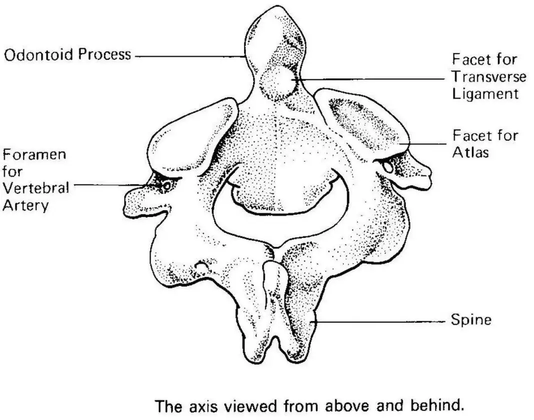 Pictures Of Axis Vertebra, Odontoid Process