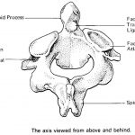 Pictures Of Axis Vertebra, Odontoid Process