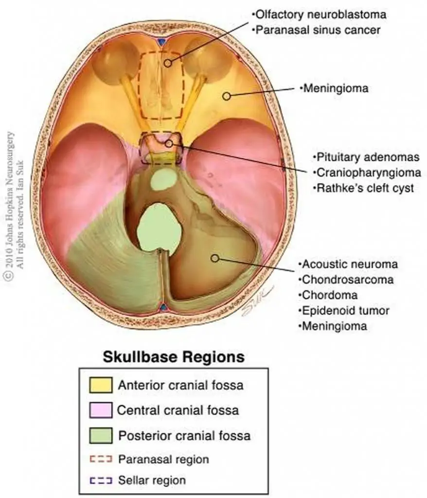 pictures-of-base-of-skull