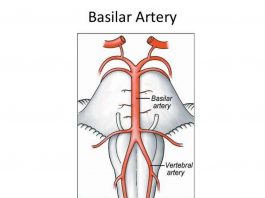 Pictures Of Basilar Artery