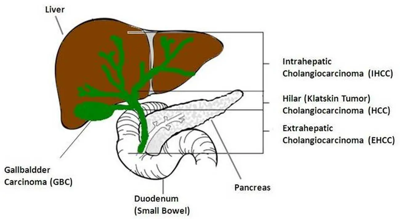 Pictures Of Biliary Tract