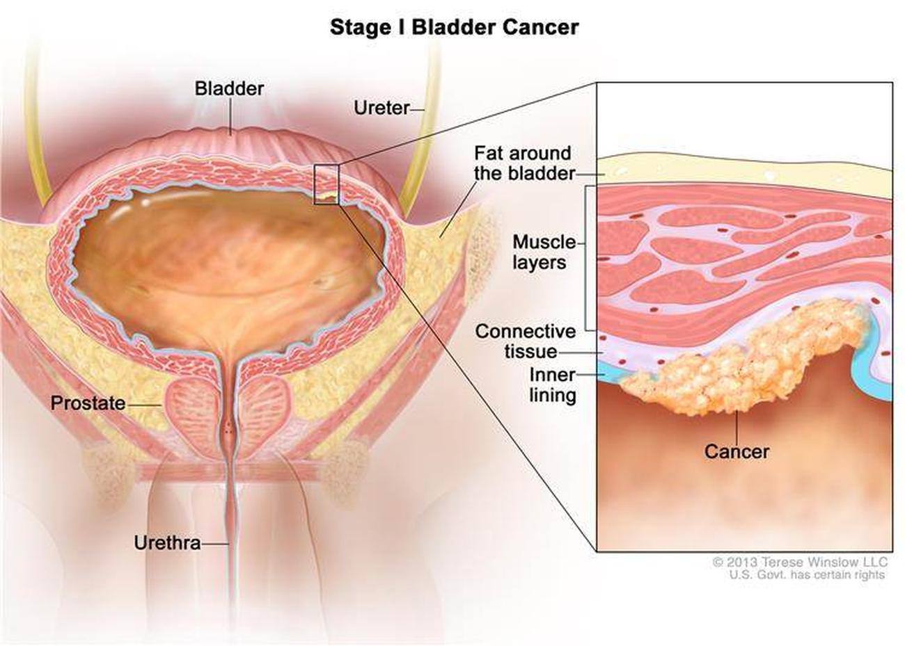 Pictures Of Bladder