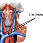 Pictures Of Brachiocephalic Vein(s)