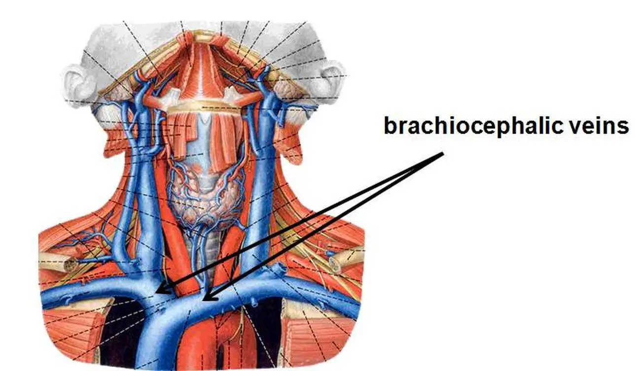 Pictures Of Brachiocephalic Vein(s)