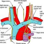 Pictures Of Brachiocephalic Vein(s)