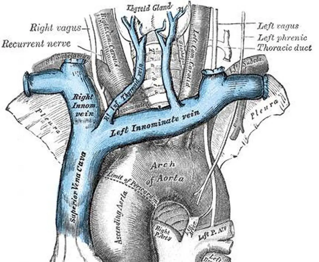 Pictures Of Brachiocephalic Vein(s)