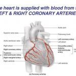 Pictures Of Cardiac Vasculature