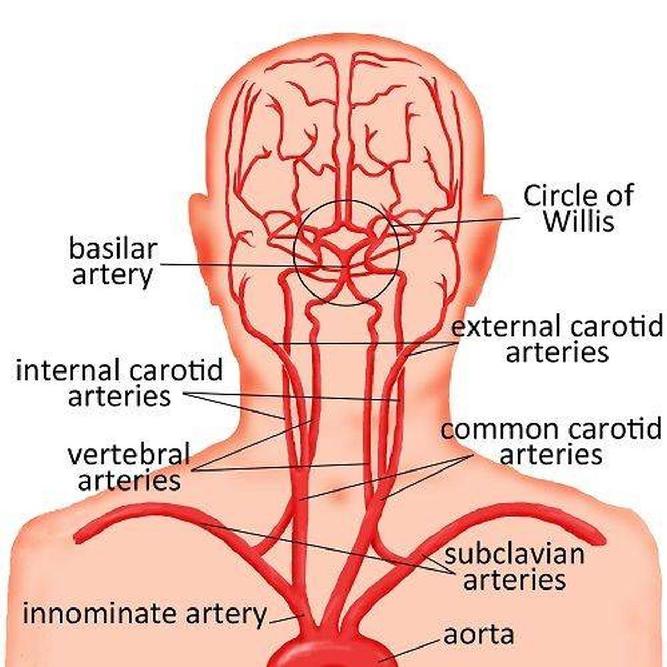 Pictures Of Carotid Arteries