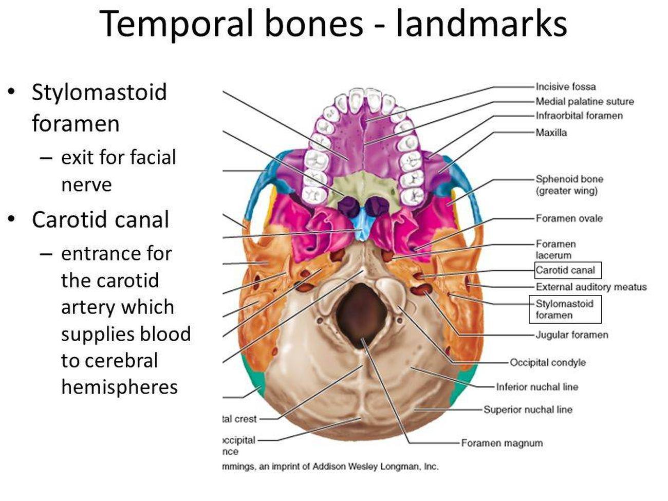 Pictures Of Carotid Canal