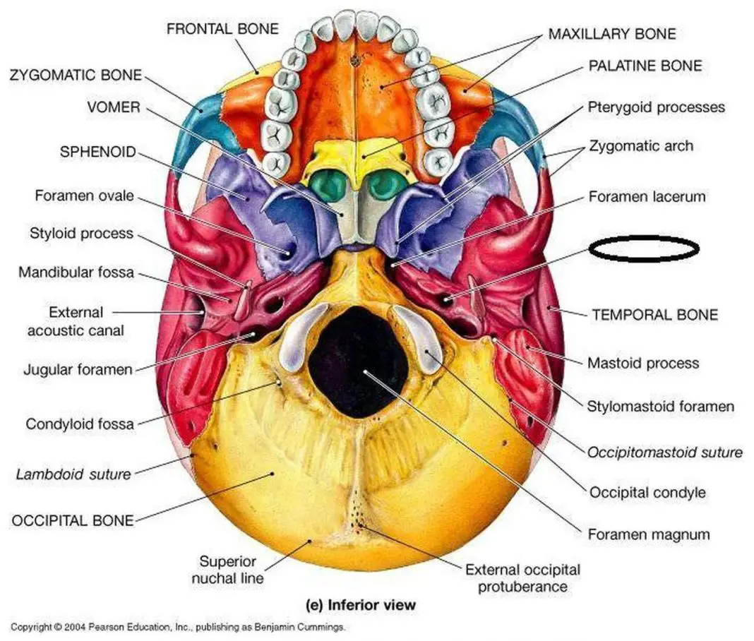 Pictures Of Carotid Canal