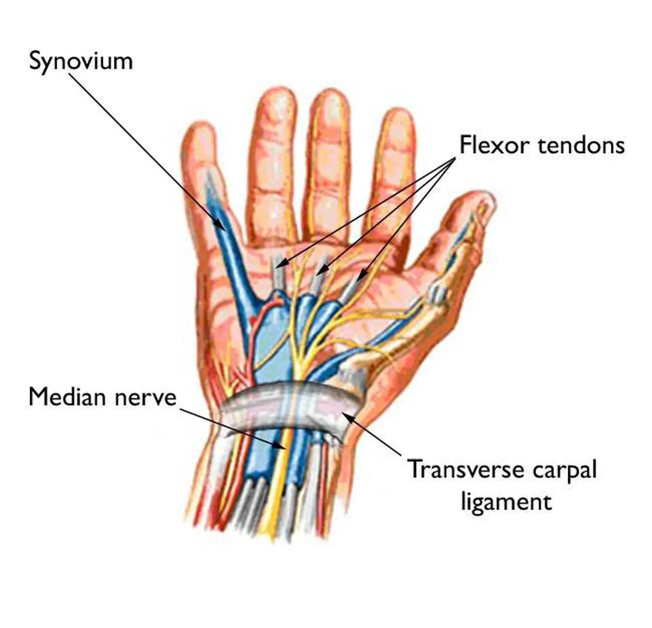 Pictures Of Carpal Tunnel